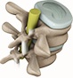 Spine - Ani Orthopaedic Group