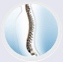 Spine Deformities
